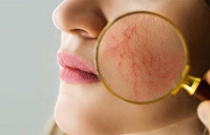 reduces dark spots and hyperpigmentation